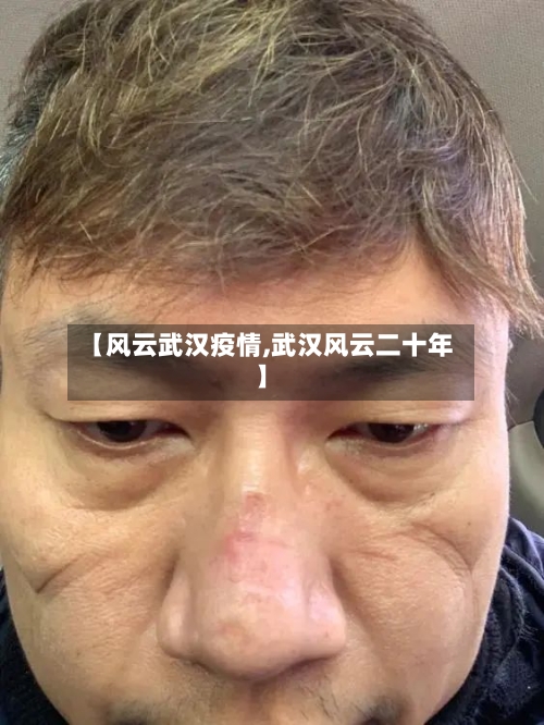 【风云武汉疫情,武汉风云二十年】-第1张图片