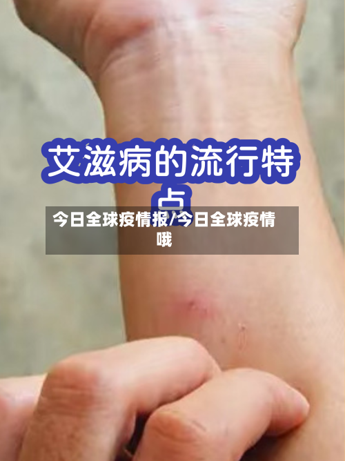 今日全球疫情报/今日全球疫情哦-第1张图片