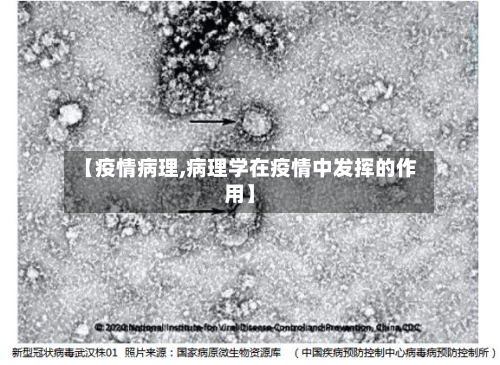 【疫情病理,病理学在疫情中发挥的作用】-第1张图片
